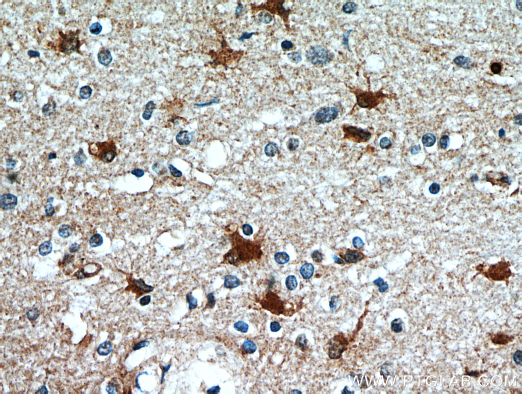 SCGBL Polyclonal antibody