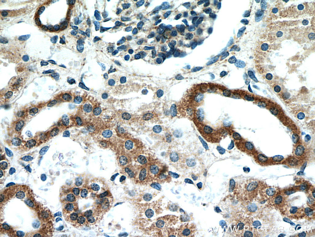 TACO1/CCDC44 Polyclonal antibody