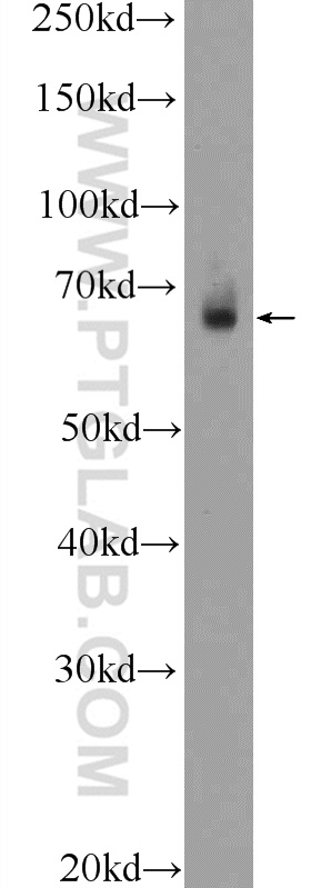 TEAD2 Polyclonal antibody