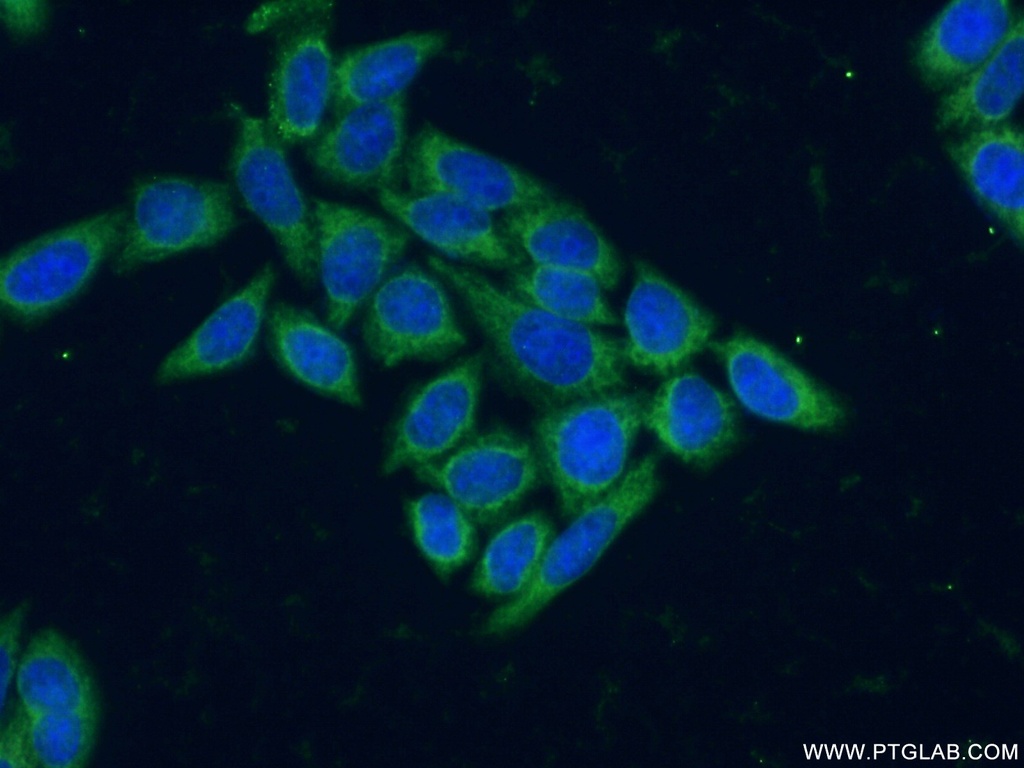 SH3BGR Polyclonal antibody