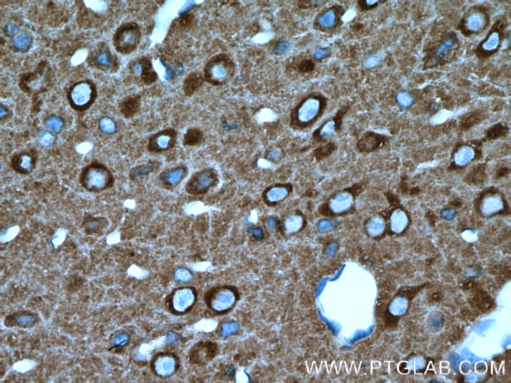 NSF Polyclonal antibody