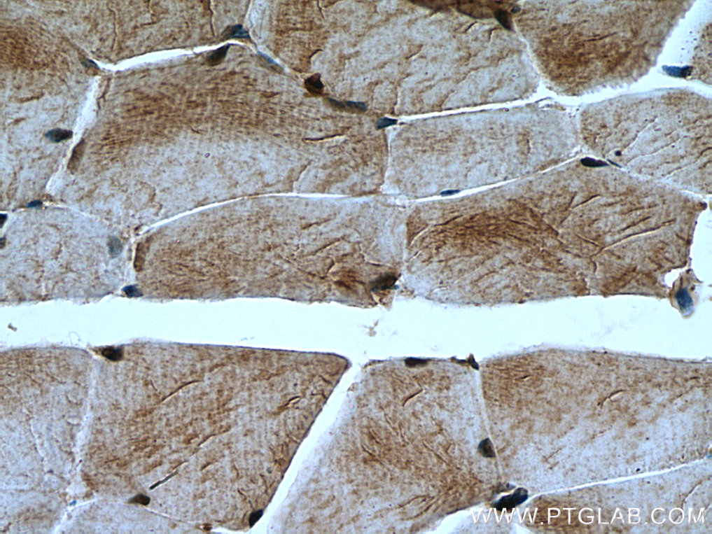 MYLK2 Polyclonal antibody