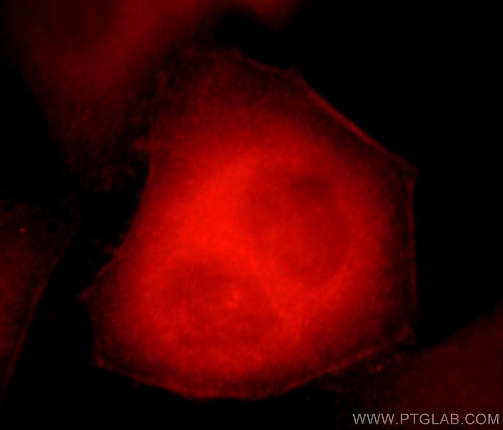 C17orf28 Polyclonal antibody