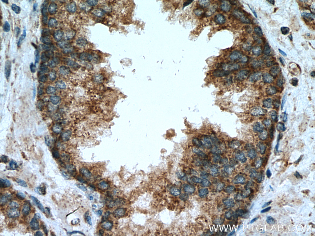 PPM2C Polyclonal antibody