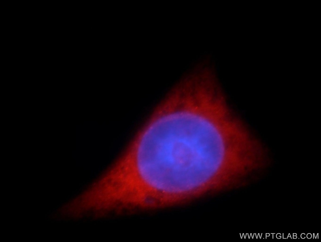 C20orf19 Polyclonal antibody