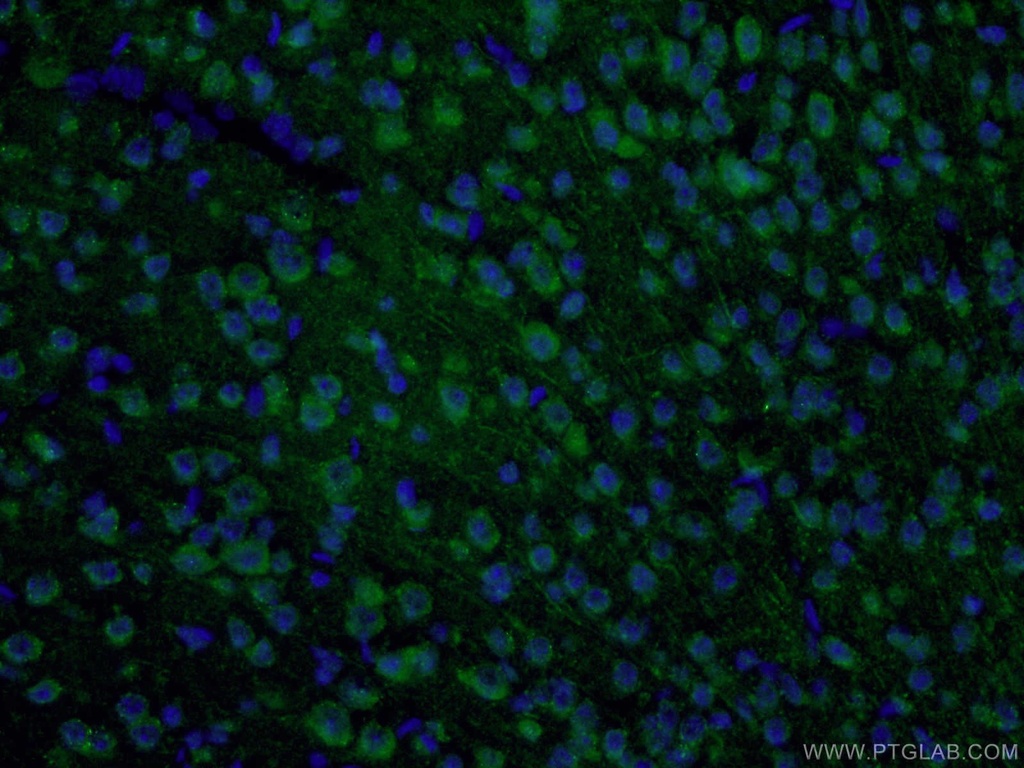 S1PR2 Polyclonal antibody