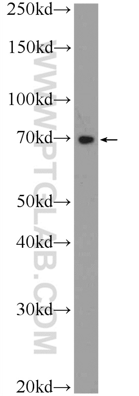 TTC30B Polyclonal antibody