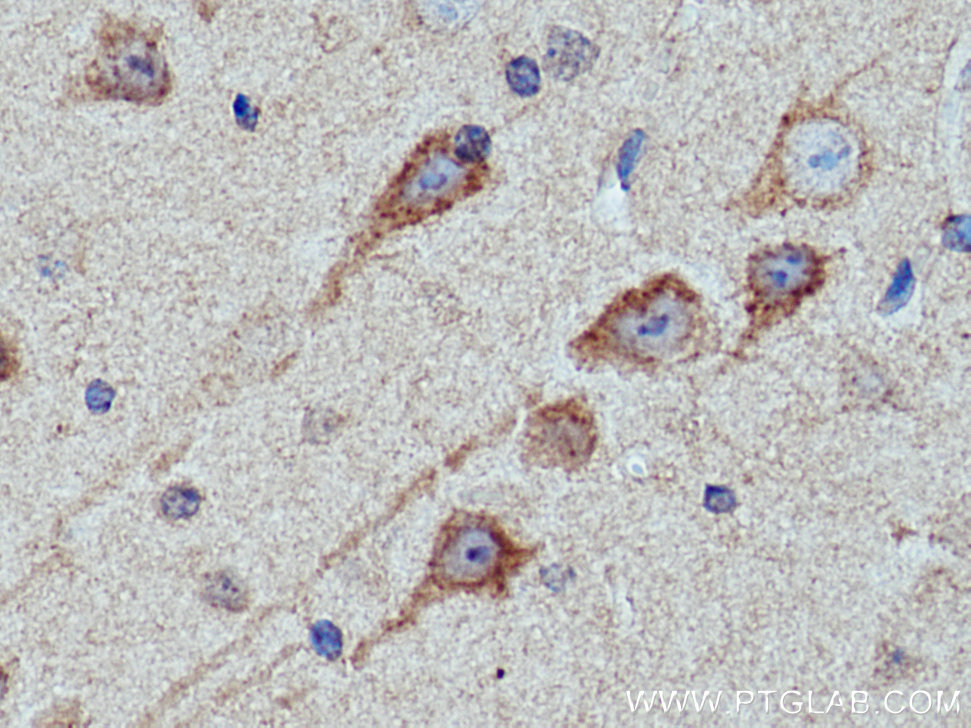 KIF5A Polyclonal antibody