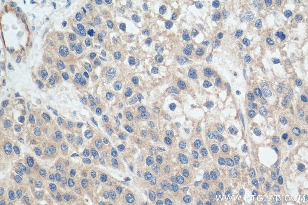 TAOK2 Polyclonal antibody