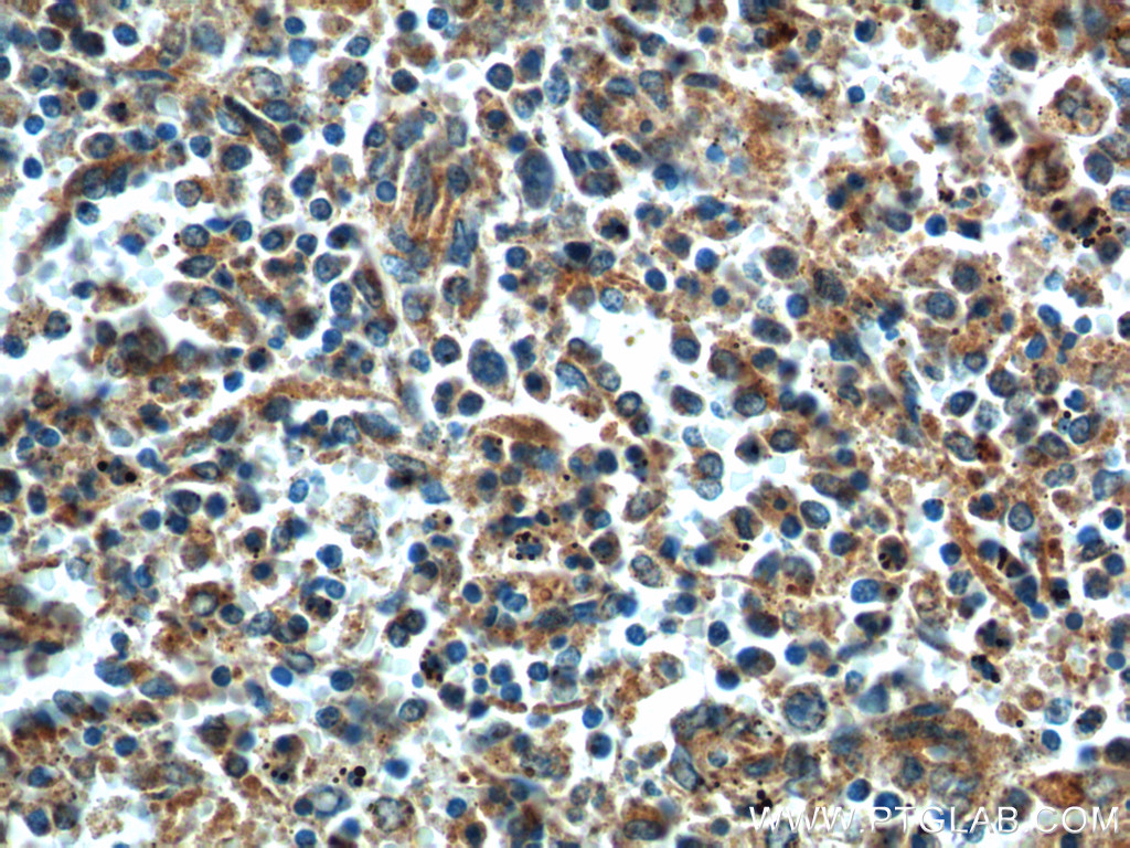 STIM2 Polyclonal antibody