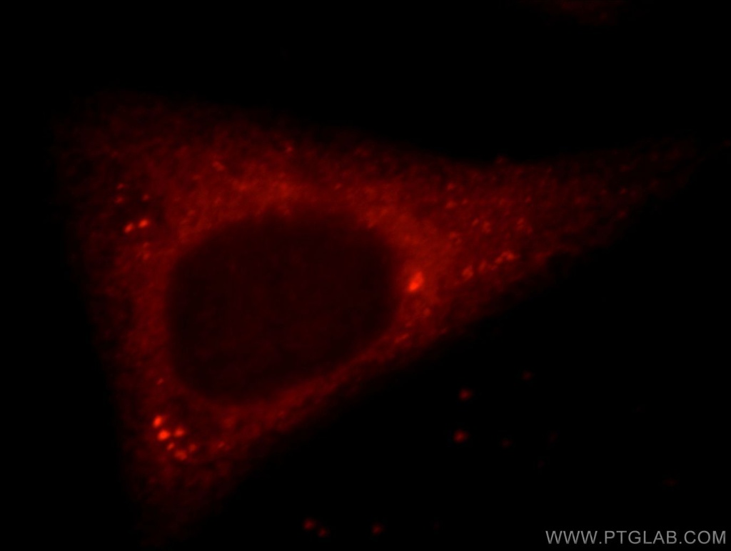 NUDCD2 Polyclonal antibody
