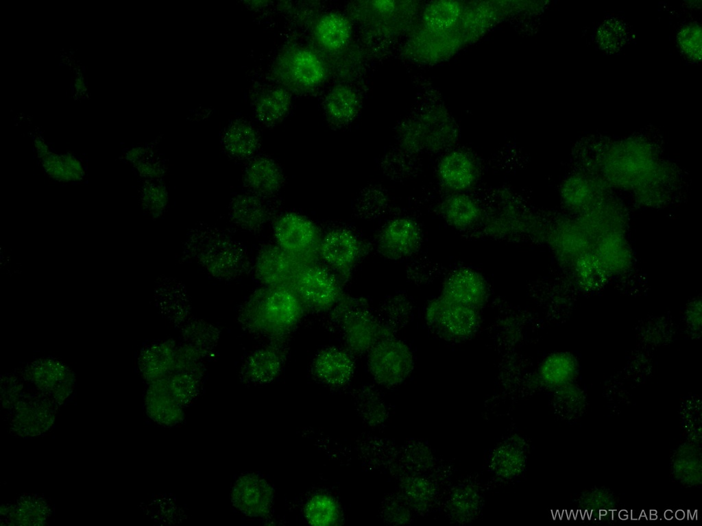 TET2 Polyclonal antibody