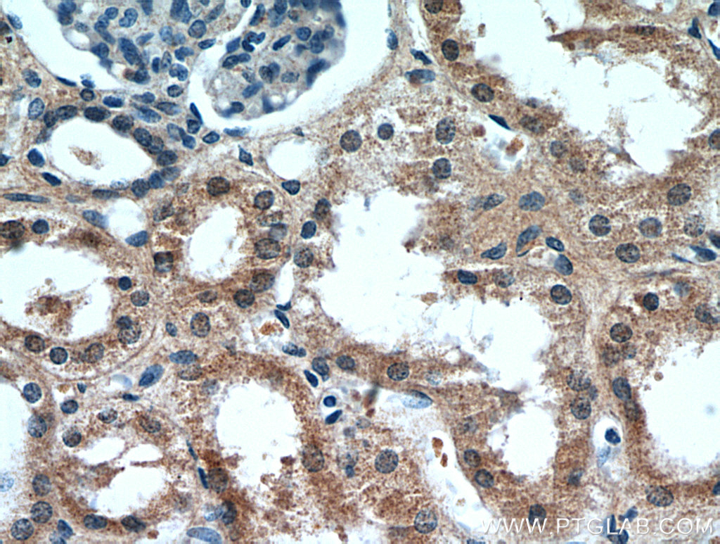 CCDC25 Polyclonal antibody
