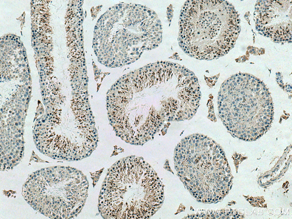 ADAD2 Polyclonal antibody