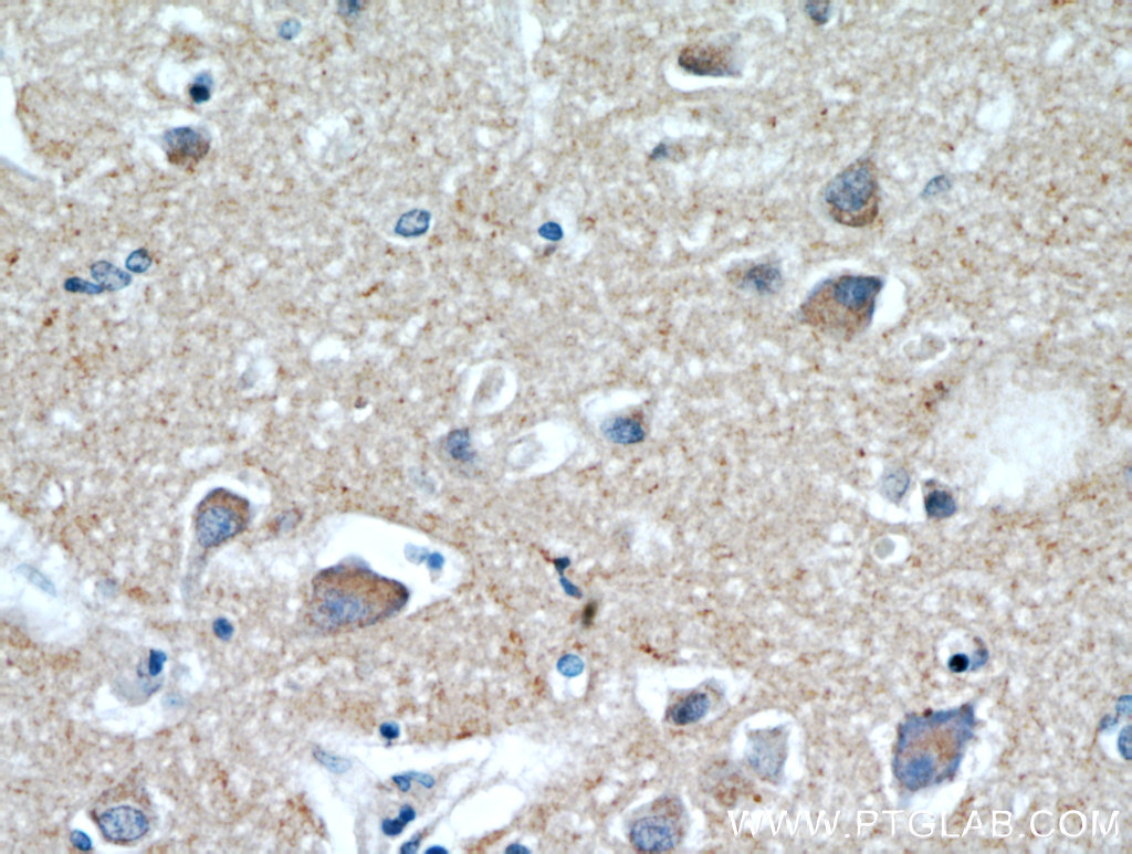 HAPLN4 Polyclonal antibody