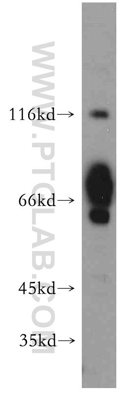 FOXJ3 Polyclonal antibody