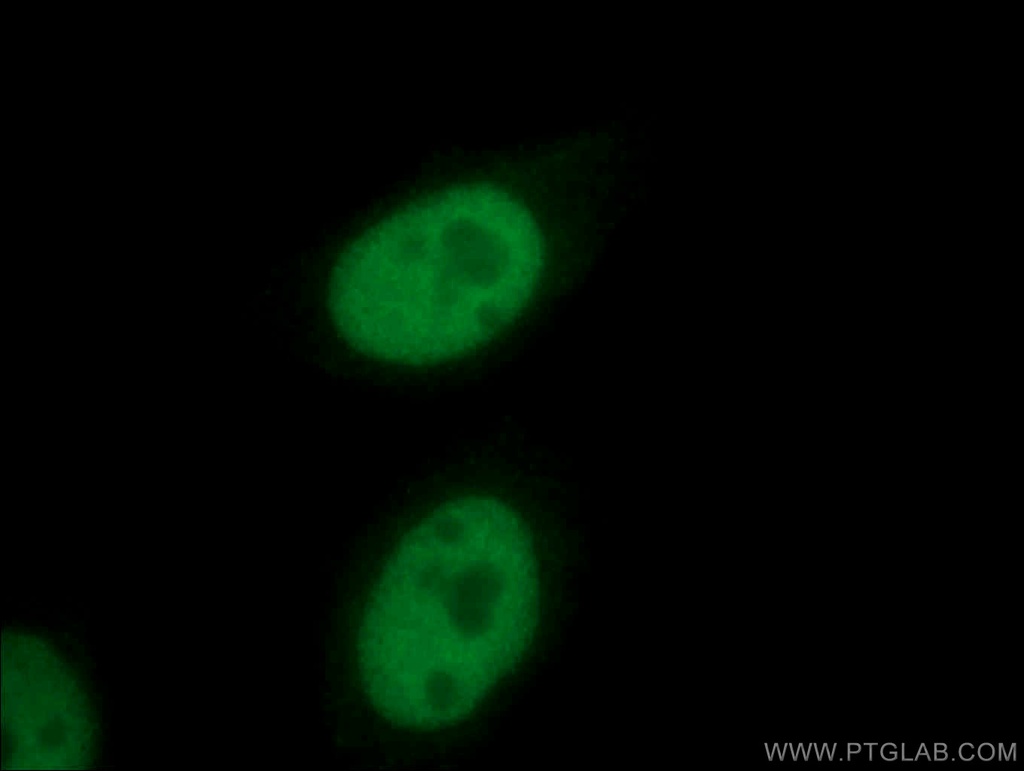 E2A Polyclonal antibody