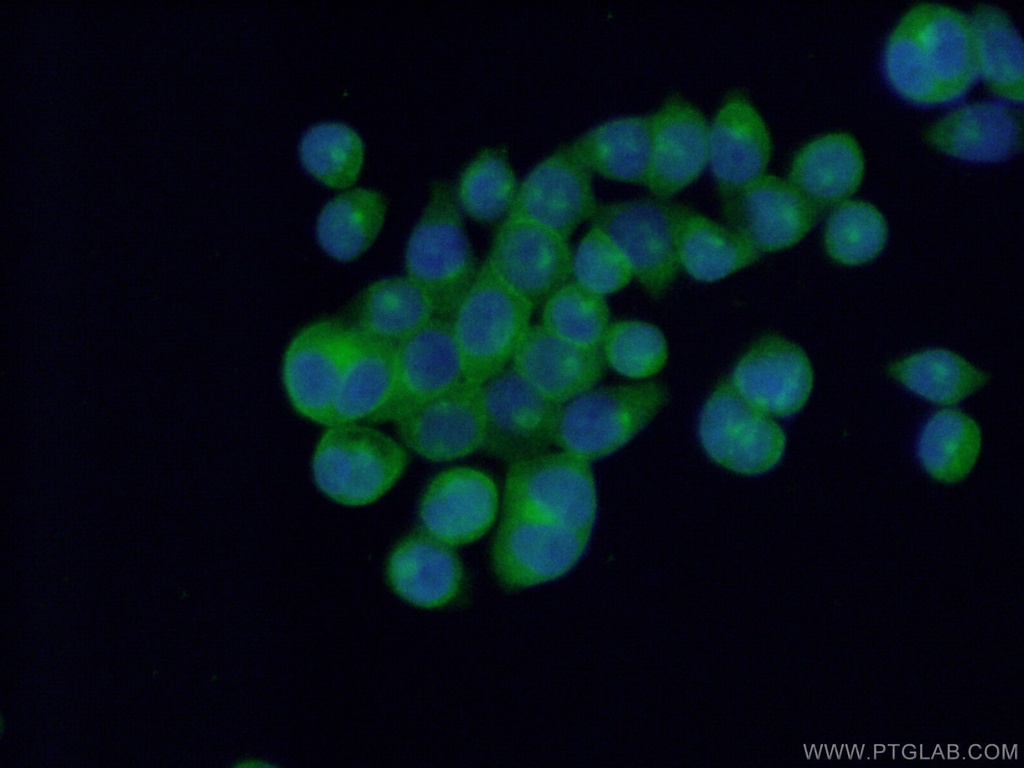 EPS15R Polyclonal antibody