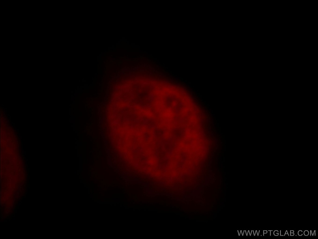 CTR9 Polyclonal antibody