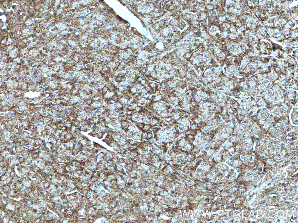 SV2C Polyclonal antibody