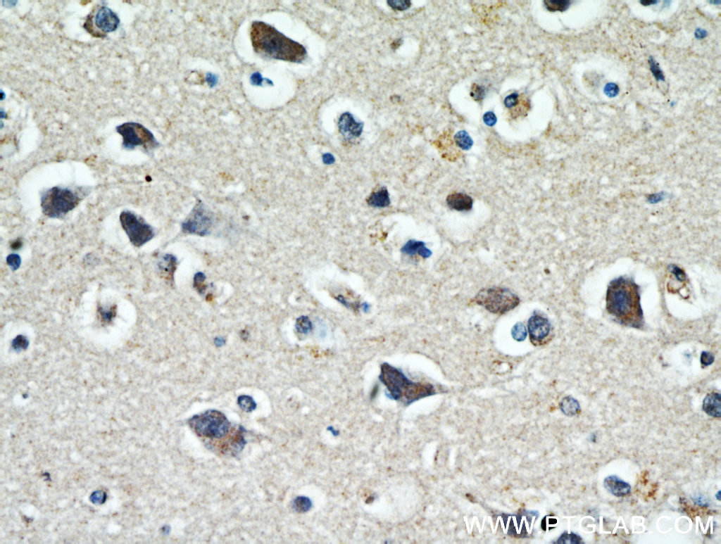 WBSCR17 Polyclonal antibody