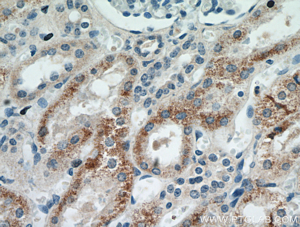 MOGAT2 Polyclonal antibody