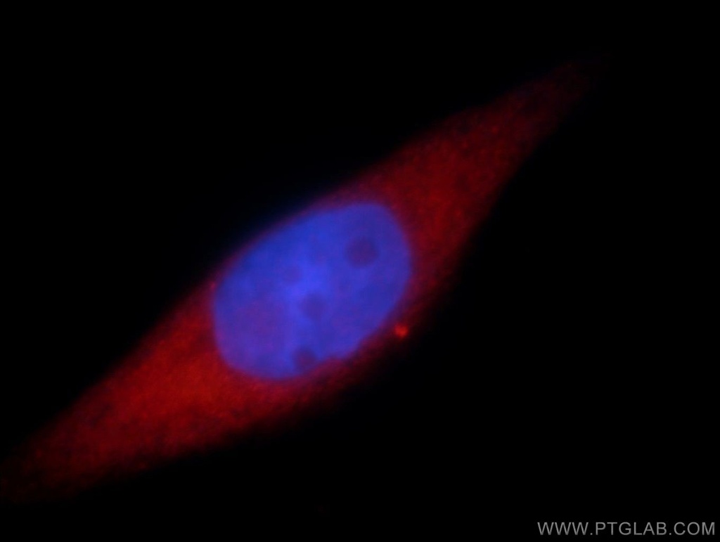 SMYD2 Polyclonal antibody