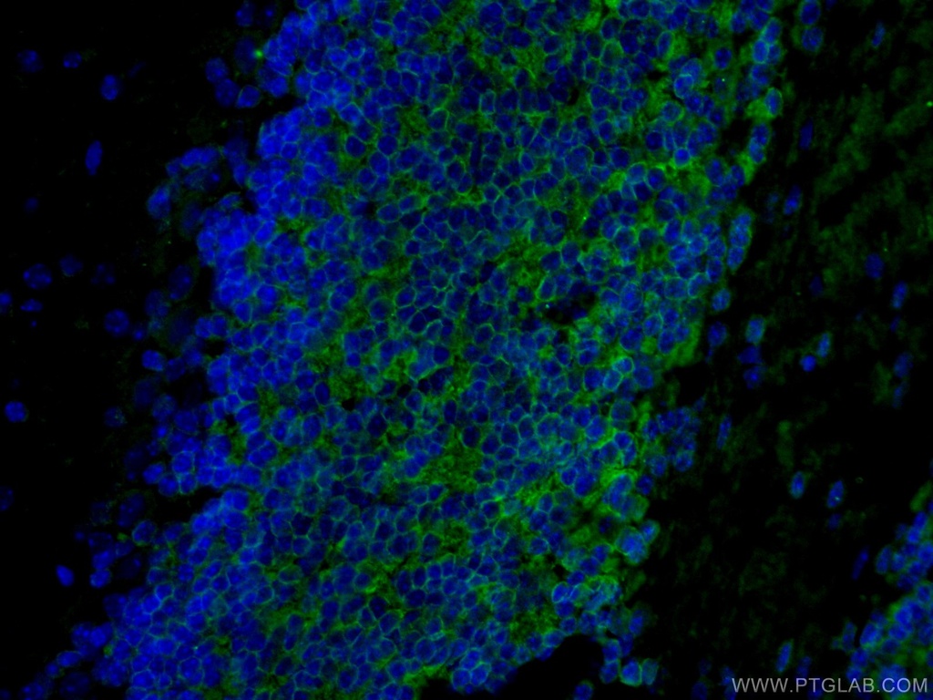 Kv4.2 Polyclonal antibody