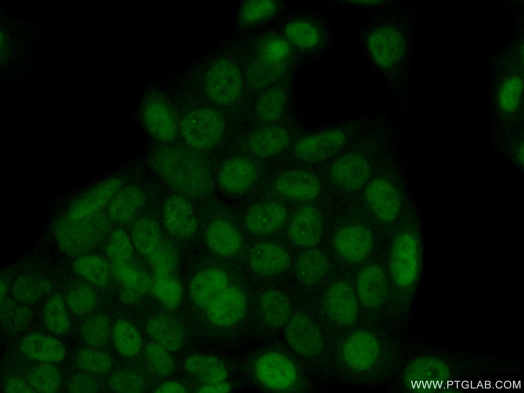 SIX4 Polyclonal antibody