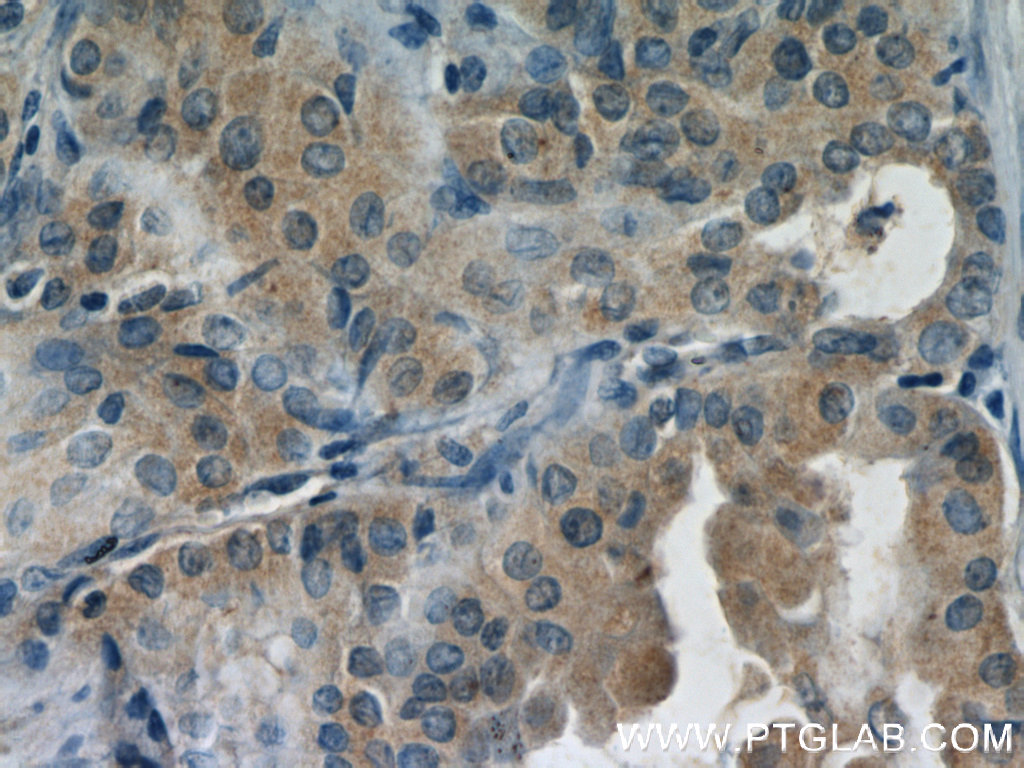 DEPDC6 Polyclonal antibody