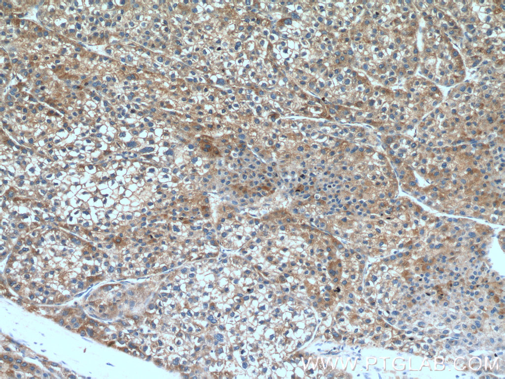 GTSE1 Polyclonal antibody