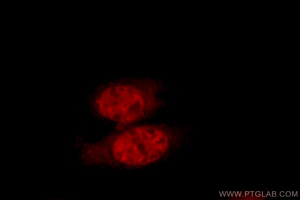 ZNF23 Polyclonal antibody