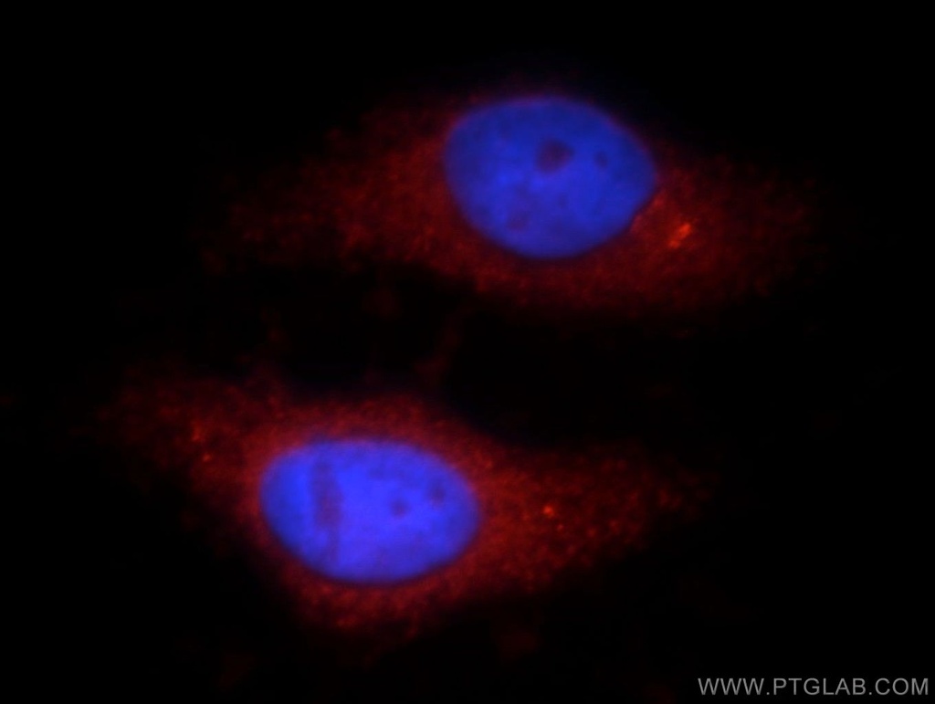 TTC39A Polyclonal antibody