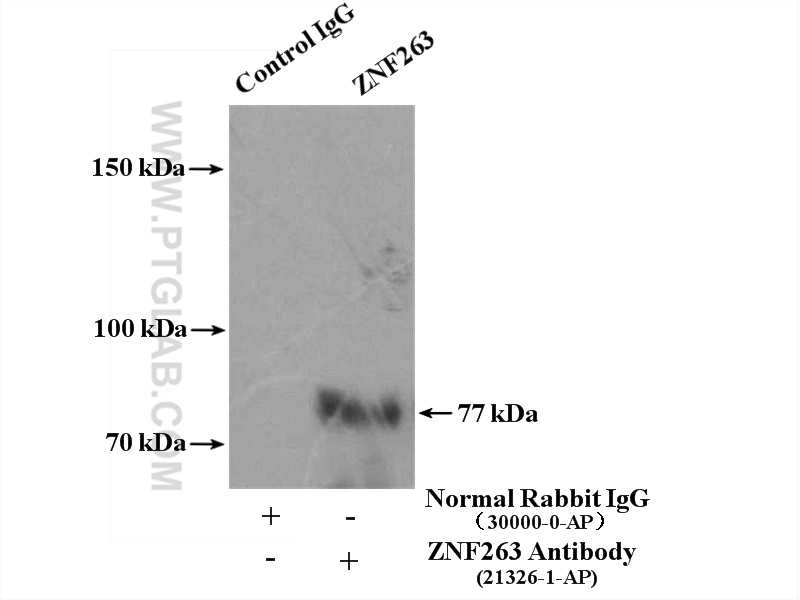 ZNF263 Polyclonal antibody