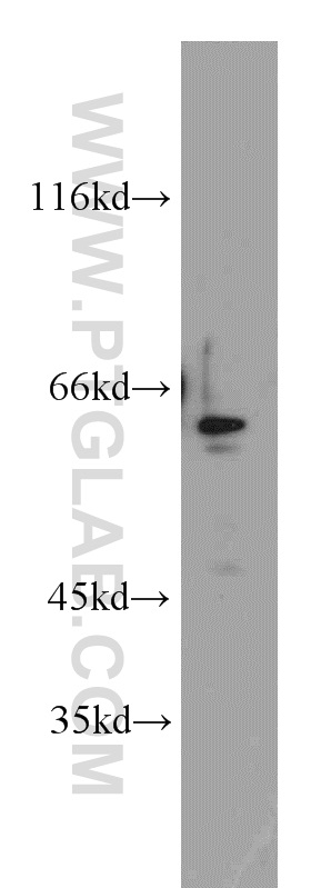 ZNF671 Polyclonal antibody