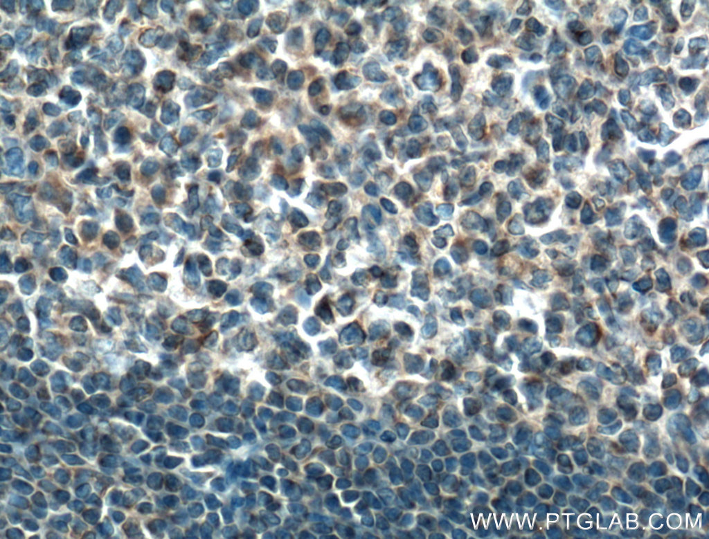 MTMR3 Polyclonal antibody