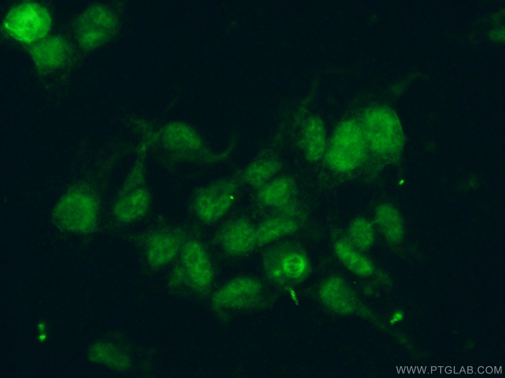 RBM39 Polyclonal antibody