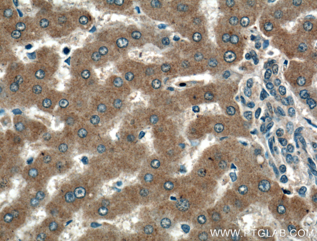 TMEM195 Polyclonal antibody