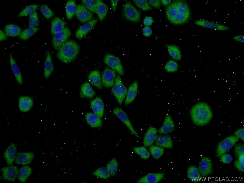 ECM2 Polyclonal antibody