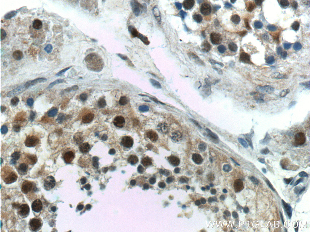 GTF2A1 Polyclonal antibody