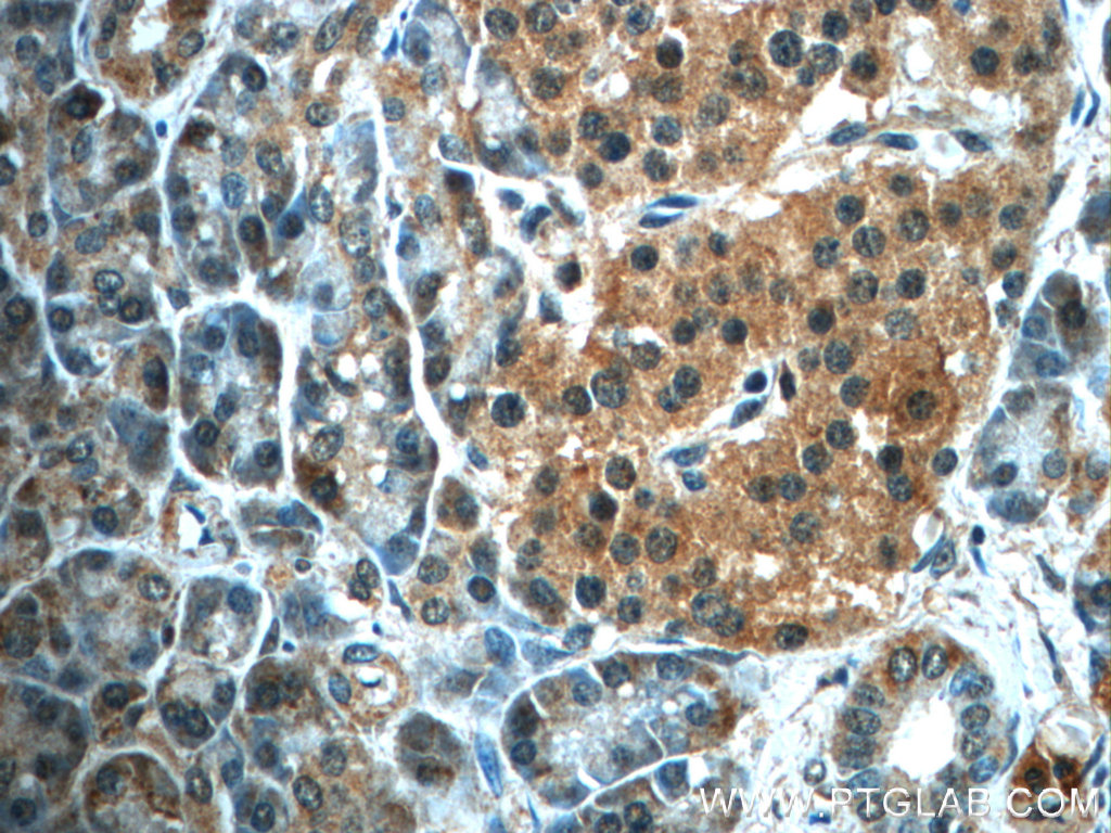 ALDH1L2 Polyclonal antibody