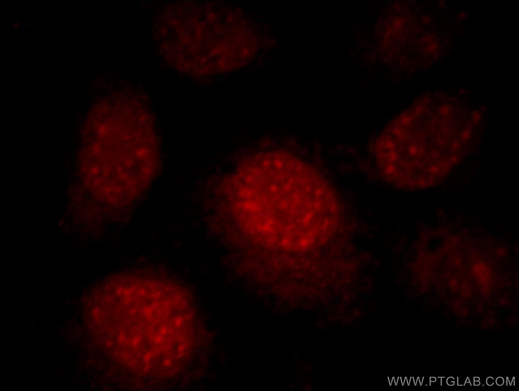 RNF168 Polyclonal antibody