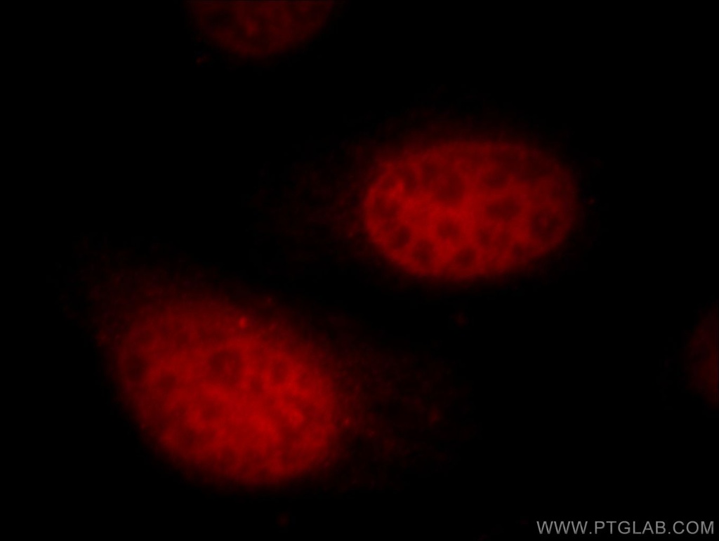 UHRF1 Polyclonal antibody