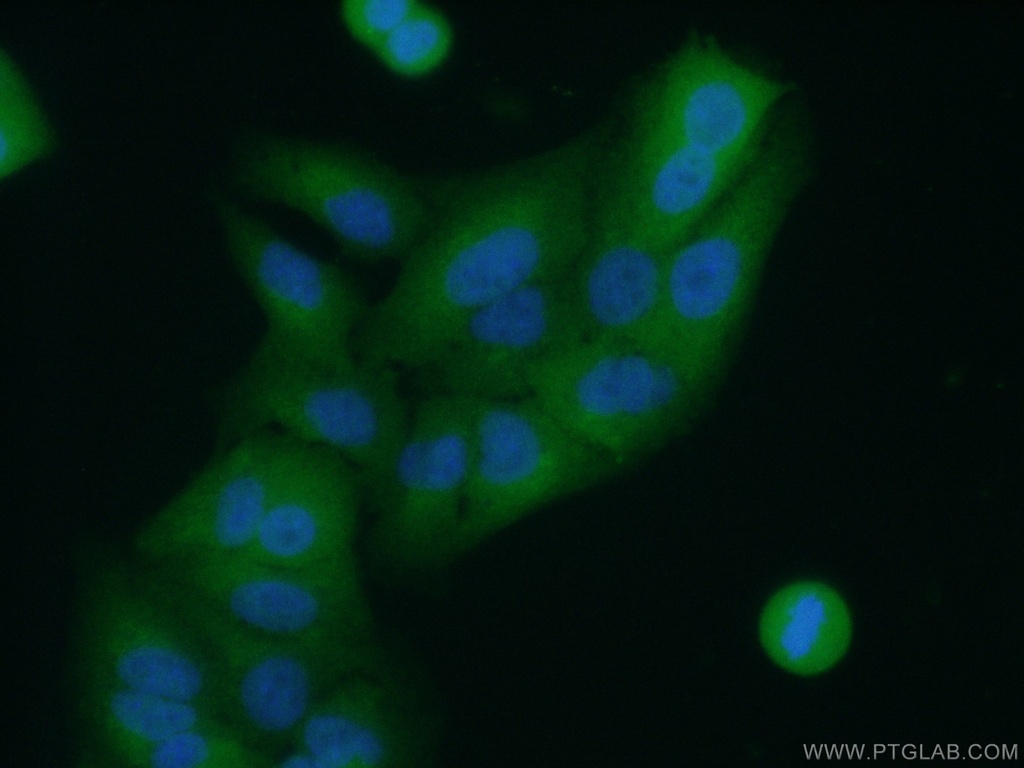 APRT Polyclonal antibody