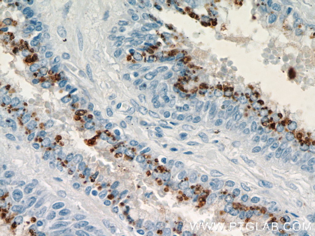 PLA2G4F Polyclonal antibody