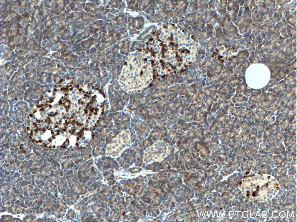 CHIT1 Polyclonal antibody