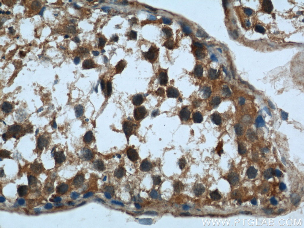Rubicon Polyclonal antibody