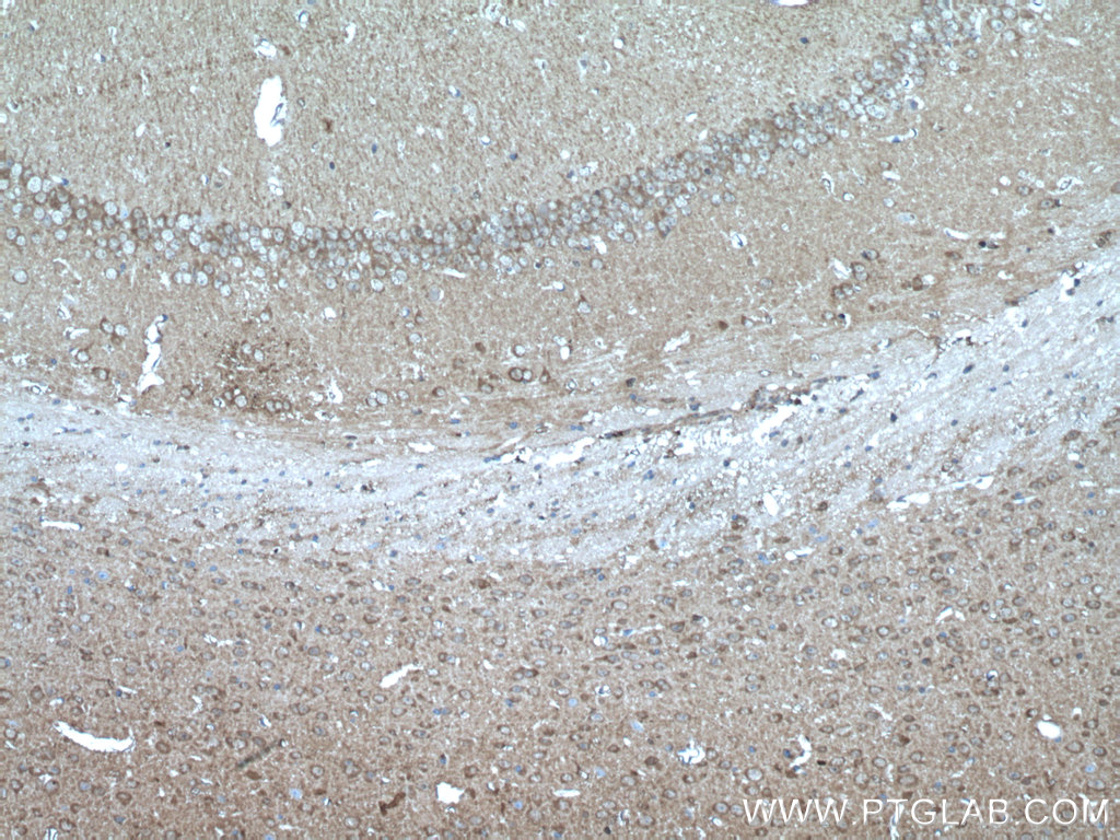 PEA15 Polyclonal antibody
