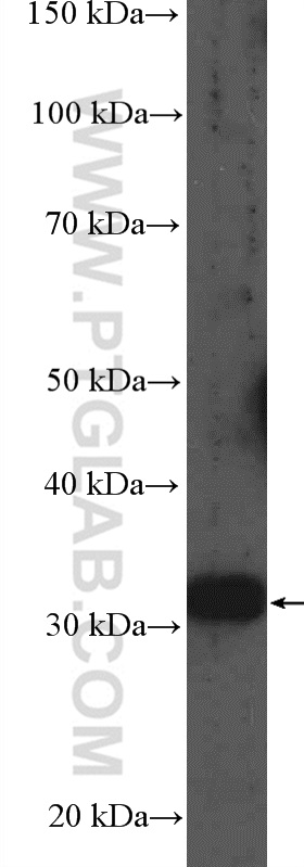 MMACHC Polyclonal antibody