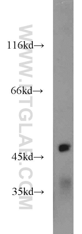 IGSF21 Polyclonal antibody